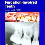 Furcation Involved Teeth